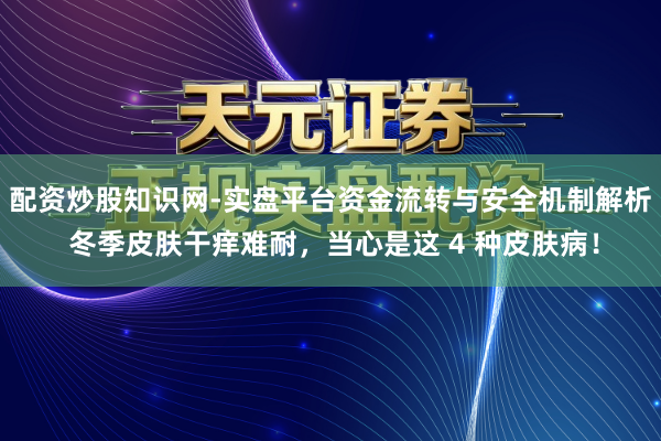 配资炒股知识网-实盘平台资金流转与安全机制解析 冬季皮肤干痒难耐，当心是这 4 种皮肤病！